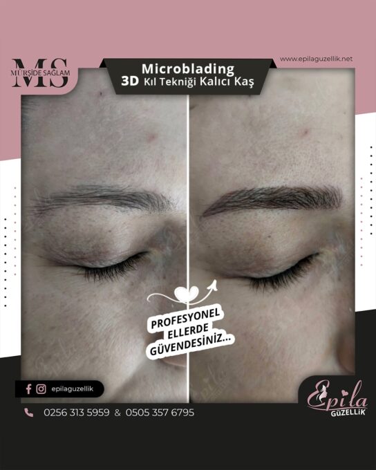 Nazilli - Microblading 3D Kıl Tekniği Kalıcı Kaş Kontürü