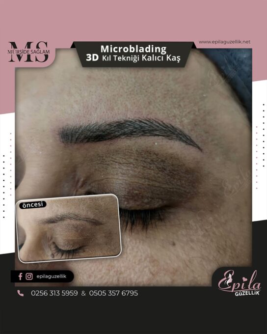 Nazilli - Microblading 3D Kıl Tekniği Kalıcı Kaş Kontürü