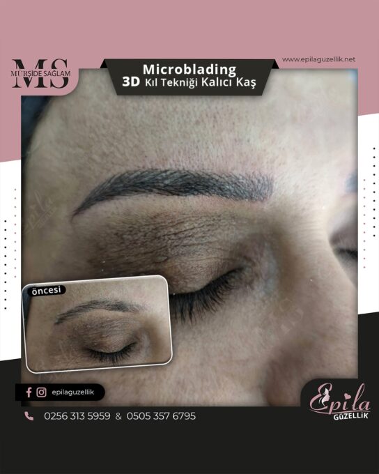 Nazilli - Microblading 3D Kıl Tekniği Kalıcı Kaş Kontürü