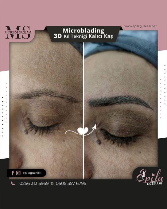 Nazilli - Microblading 3D Kıl Tekniği Kalıcı Kaş Kontürü