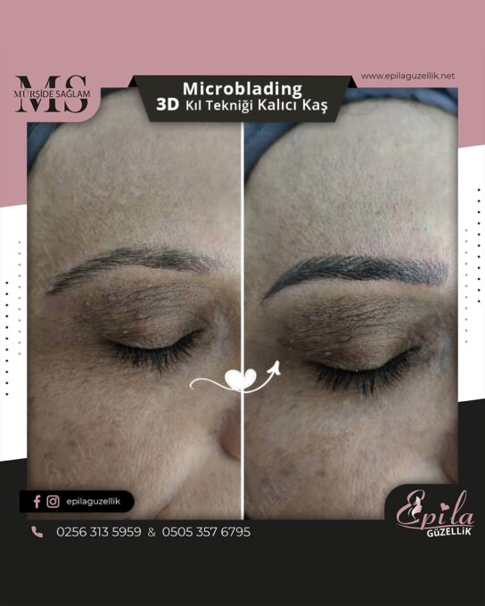 Nazilli - Microblading 3D Kıl Tekniği Kalıcı Kaş Kontürü