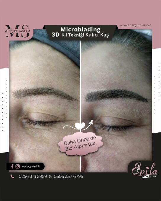 Nazilli - Microblading 3D Kıl Tekniği Kalıcı Kaş Kontürü