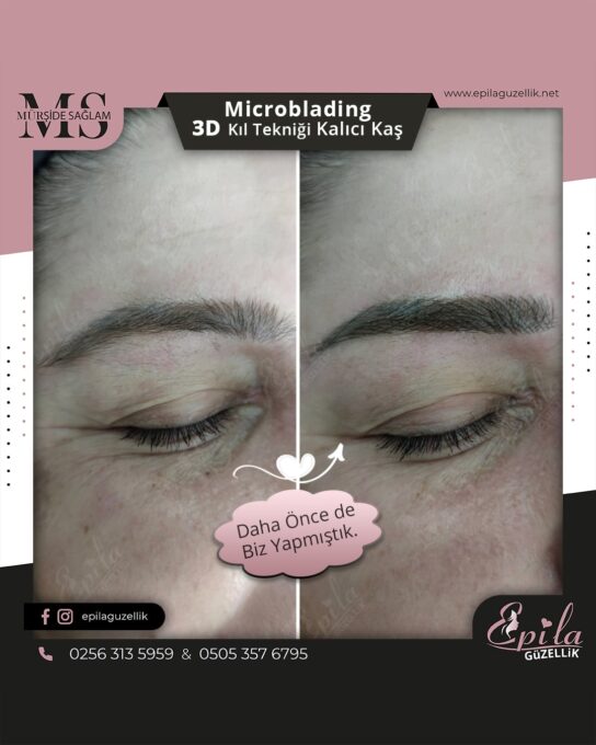 Nazilli - Microblading 3D Kıl Tekniği Kalıcı Kaş Kontürü