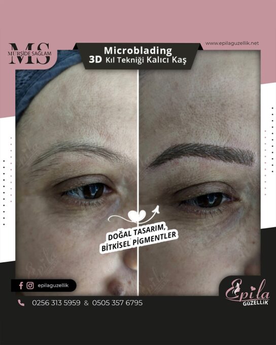 Nazilli - Microblading 3D Kıl Tekniği Kalıcı Kaş Kontürü