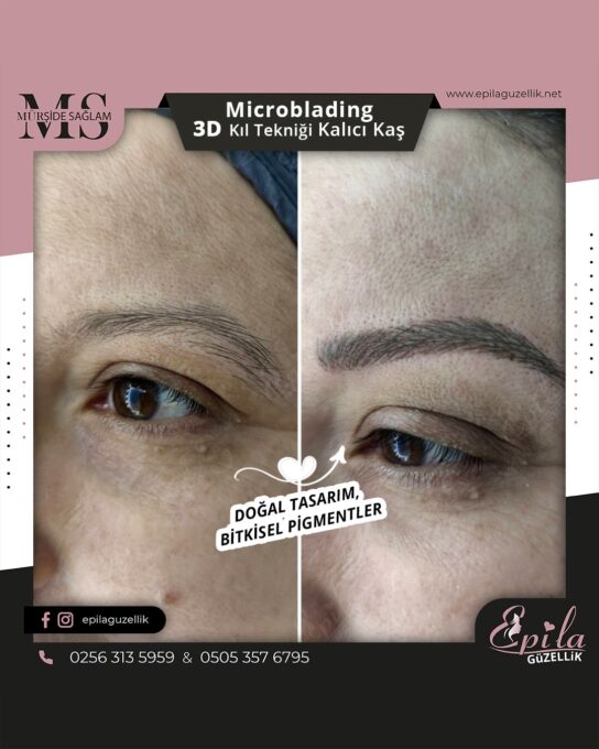 Nazilli - Microblading 3D Kıl Tekniği Kalıcı Kaş Kontürü