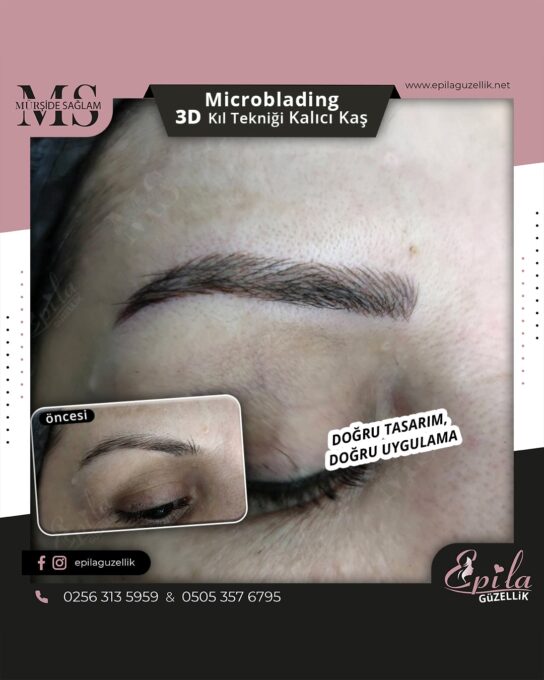 Nazilli - Microblading 3D Kıl Tekniği Kalıcı Kaş Kontürü