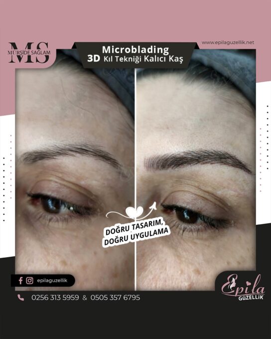 Nazilli - Microblading 3D Kıl Tekniği Kalıcı Kaş Kontürü