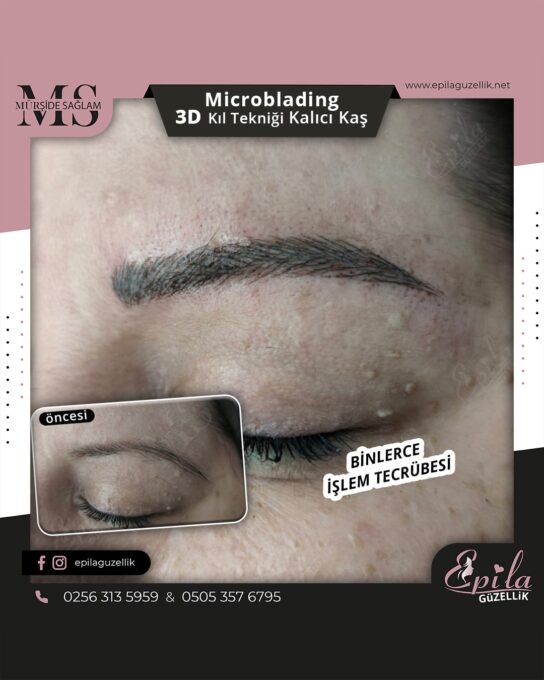 Nazilli - Microblading 3D Kıl Tekniği Kalıcı Kaş Kontürü