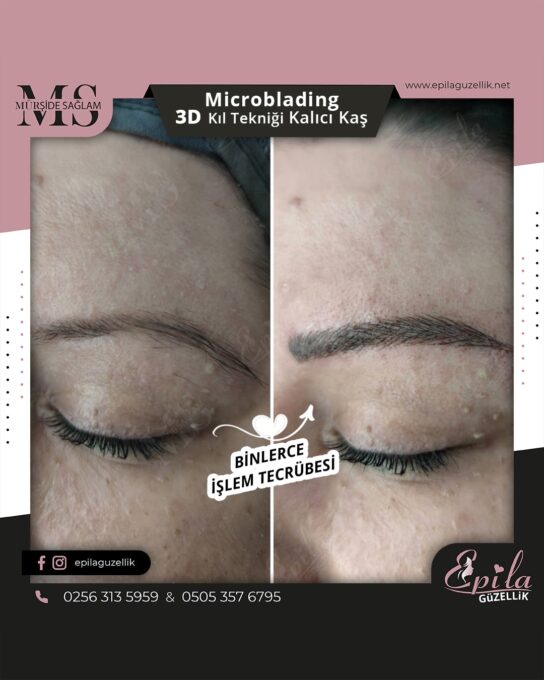 Nazilli - Microblading 3D Kıl Tekniği Kalıcı Kaş Kontürü