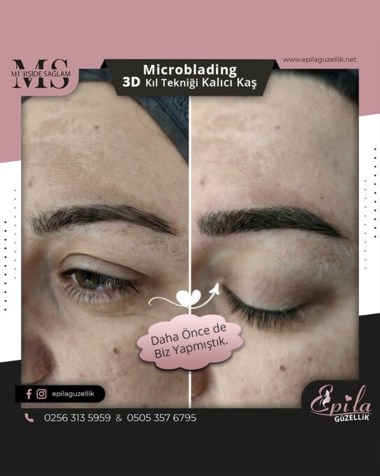 Nazilli - Microblading 3D Kıl Tekniği Kalıcı Kaş Kontürü