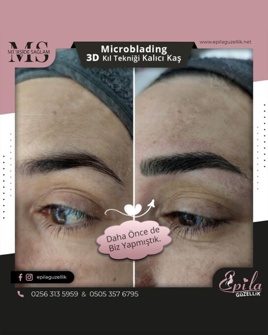 Nazilli - Microblading 3D Kıl Tekniği Kalıcı Kaş Kontürü