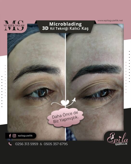 Nazilli - Microblading 3D Kıl Tekniği Kalıcı Kaş Kontürü