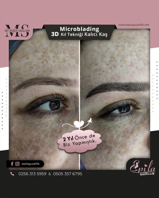 Nazilli - Microblading 3D Kıl Tekniği Kalıcı Kaş Kontürü