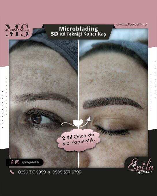 Nazilli - Microblading 3D Kıl Tekniği Kalıcı Kaş Kontürü