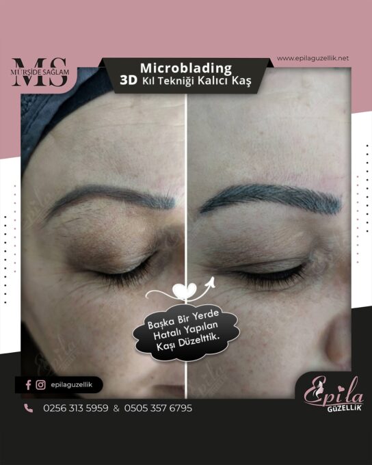 Nazilli - Microblading 3D Kıl Tekniği Kalıcı Kaş Kontürü