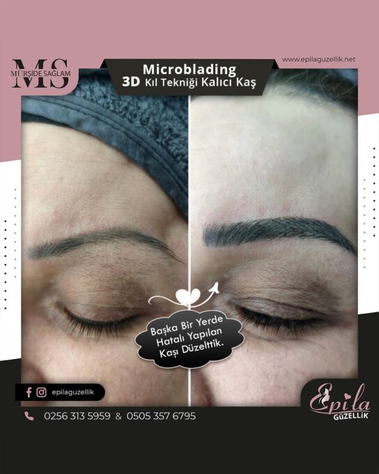 Nazilli - Microblading 3D Kıl Tekniği Kalıcı Kaş Kontürü