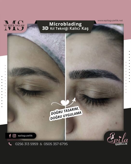 Nazilli - Microblading 3D Kıl Tekniği Kalıcı Kaş Kontürü