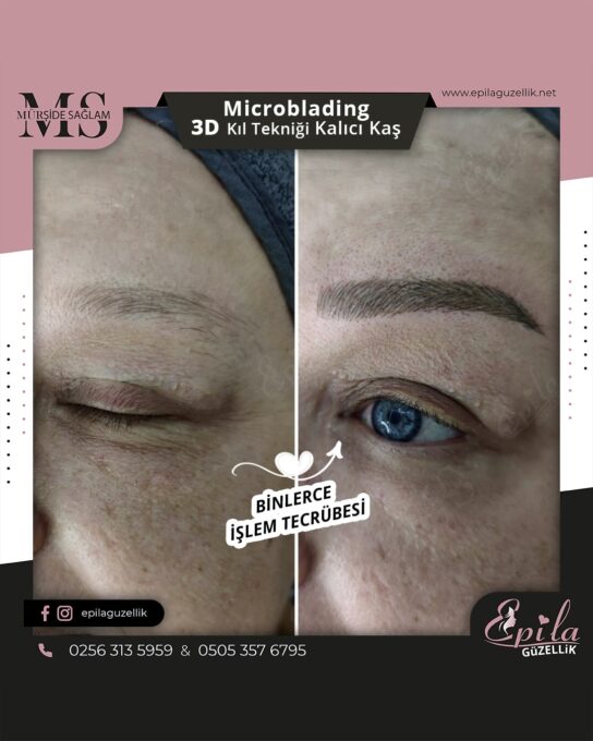 Nazilli - Microblading 3D Kıl Tekniği Kalıcı Kaş Kontürü