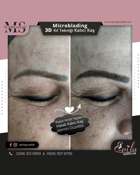 Nazilli - Microblading 3D Kıl Tekniği Kalıcı Kaş Kontürü