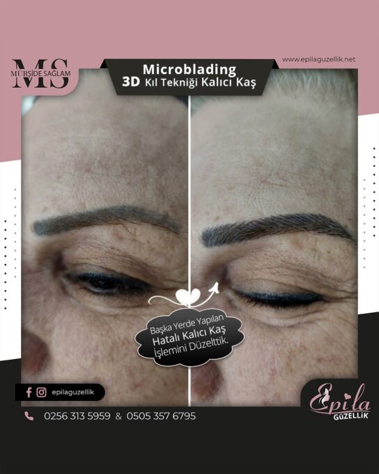 Nazilli - Microblading 3D Kıl Tekniği Kalıcı Kaş Kontürü