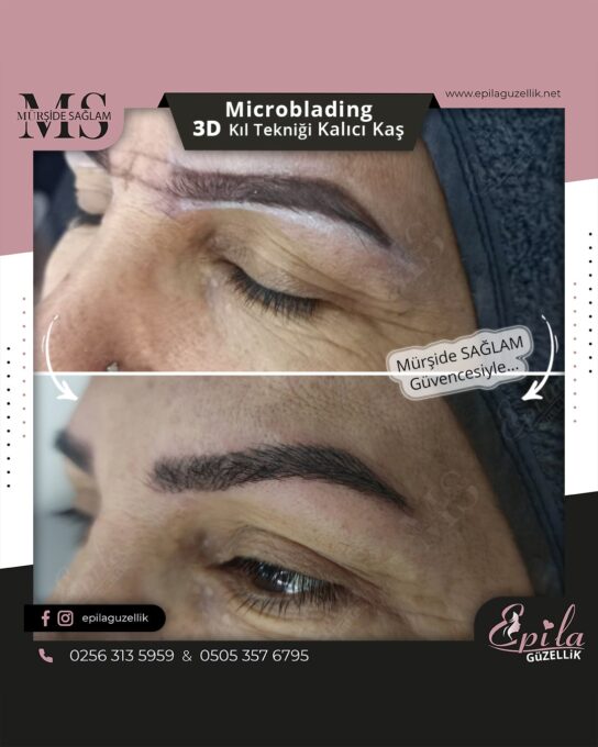 Nazilli - Microblading 3D Kıl Tekniği Kalıcı Kaş Kontürü