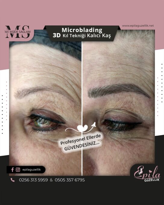 Nazilli - Microblading 3D Kıl Tekniği Kalıcı Kaş Kontürü