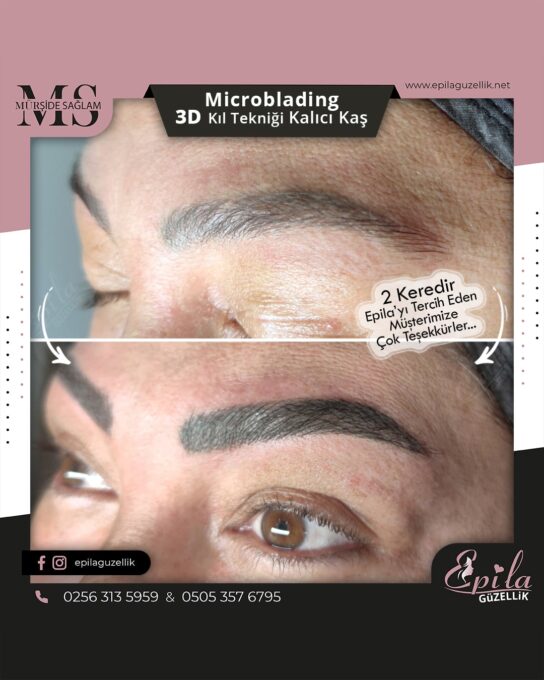 Nazilli - Microblading 3D Kıl Tekniği Kalıcı Kaş Kontürü