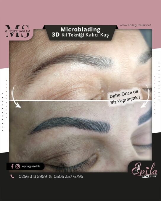 Nazilli - Microblading 3D Kıl Tekniği Kalıcı Kaş Kontürü