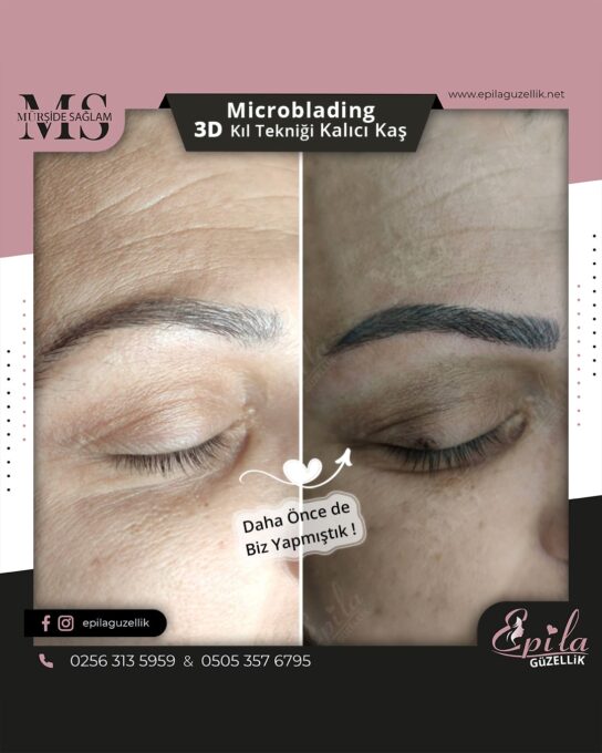 Nazilli - Microblading 3D Kıl Tekniği Kalıcı Kaş Kontürü