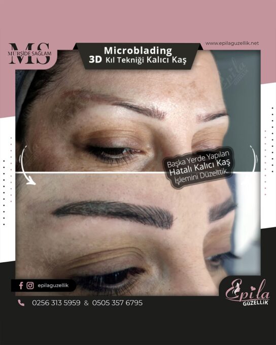 Nazilli - Microblading 3D Kıl Tekniği Kalıcı Kaş Kontürü