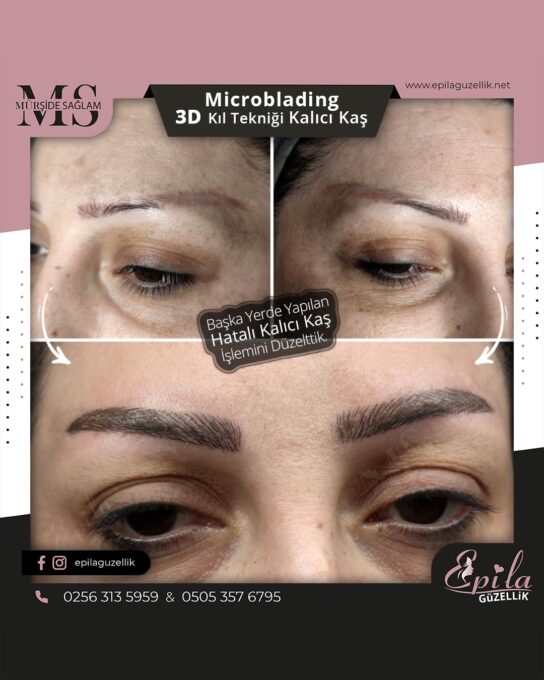 Nazilli - Microblading 3D Kıl Tekniği Kalıcı Kaş Kontürü