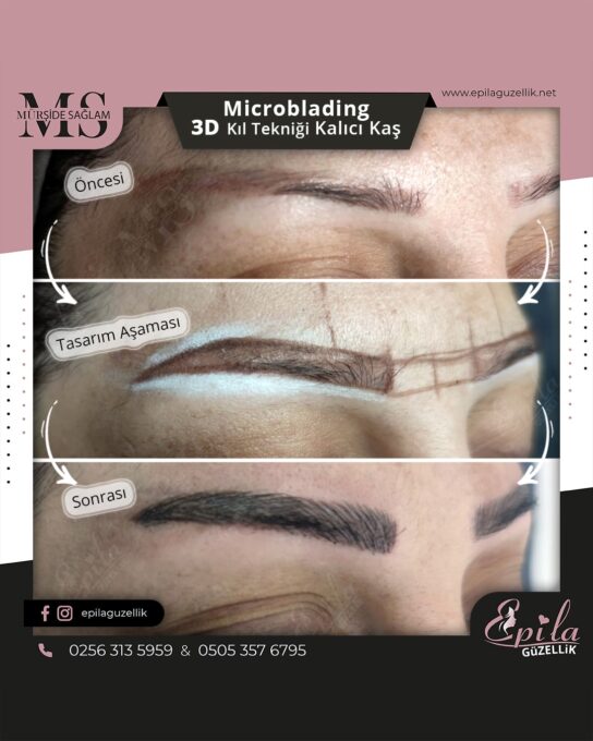 Nazilli - Microblading 3D Kıl Tekniği Kalıcı Kaş Kontürü