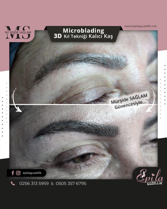 Nazilli - Microblading 3D Kıl Tekniği Kalıcı Kaş Kontürü