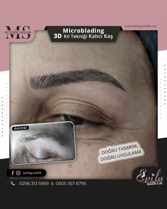 Nazilli - Microblading 3D Kıl Tekniği Kalıcı Kaş Kontürü