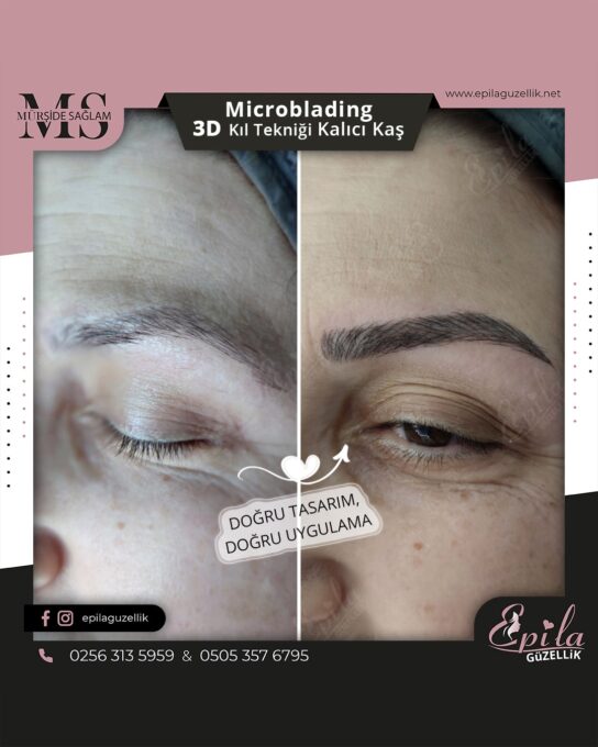 Nazilli - Microblading 3D Kıl Tekniği Kalıcı Kaş Kontürü