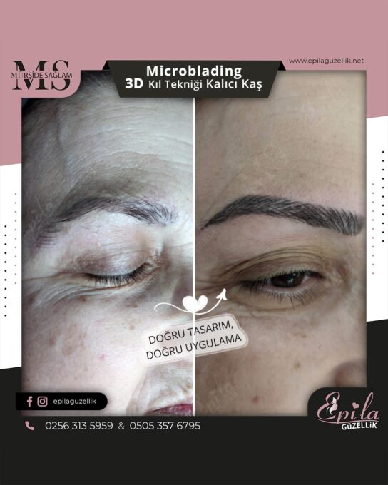 Nazilli - Microblading 3D Kıl Tekniği Kalıcı Kaş Kontürü