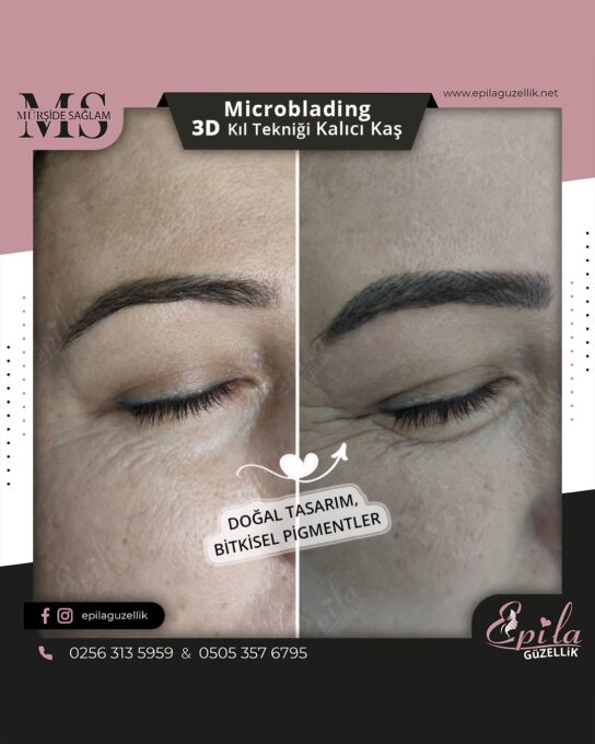 Nazilli - Microblading 3D Kıl Tekniği Kalıcı Kaş Kontürü