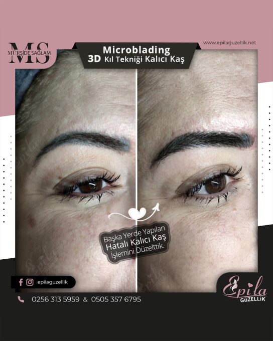 Nazilli - Microblading 3D Kıl Tekniği Kalıcı Kaş Kontürü