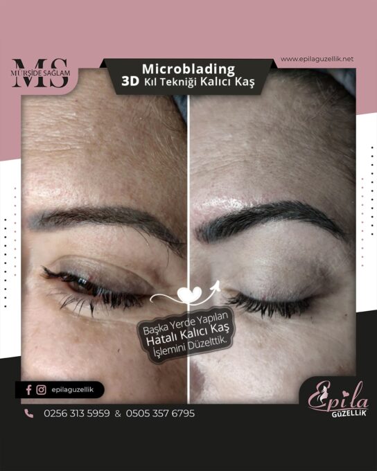 Nazilli - Microblading 3D Kıl Tekniği Kalıcı Kaş Kontürü