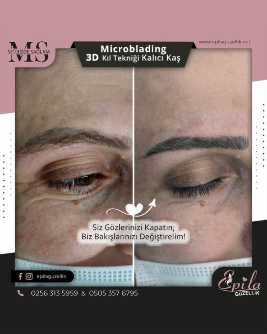 Nazilli - Microblading 3D Kıl Tekniği Kalıcı Kaş Kontürü