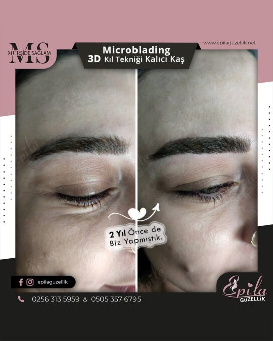 Nazilli - Microblading 3D Kıl Tekniği Kalıcı Kaş Kontürü