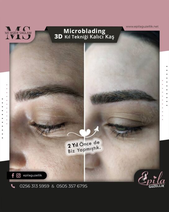 Nazilli - Microblading 3D Kıl Tekniği Kalıcı Kaş Kontürü