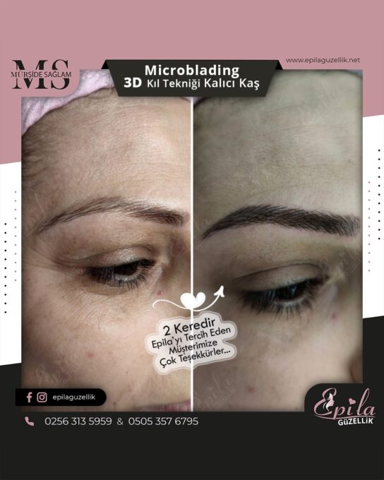 Nazilli - Microblading 3D Kıl Tekniği Kalıcı Kaş Kontürü