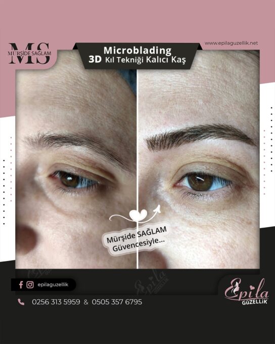 Nazilli - Microblading 3D Kıl Tekniği Kalıcı Kaş Kontürü