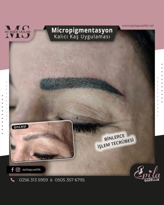 Nazilli - Microblading 3D Kıl Tekniği Kalıcı Kaş Kontürü