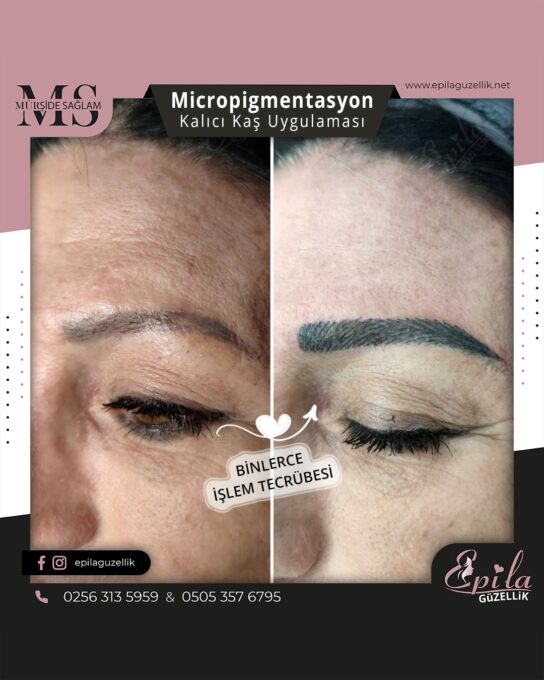 Nazilli - Microblading 3D Kıl Tekniği Kalıcı Kaş Kontürü