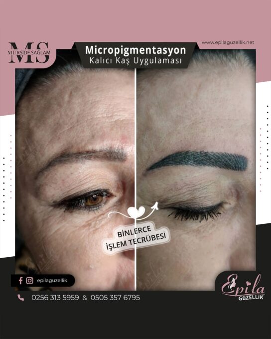 Nazilli - Microblading 3D Kıl Tekniği Kalıcı Kaş Kontürü