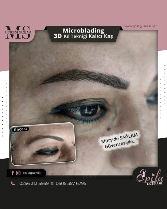 Nazilli - Microblading 3D Kıl Tekniği Kalıcı Kaş Kontürü