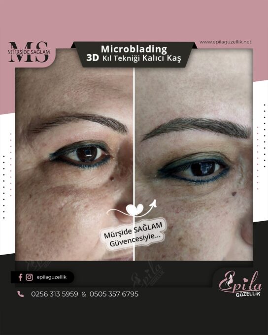 Nazilli - Microblading 3D Kıl Tekniği Kalıcı Kaş Kontürü