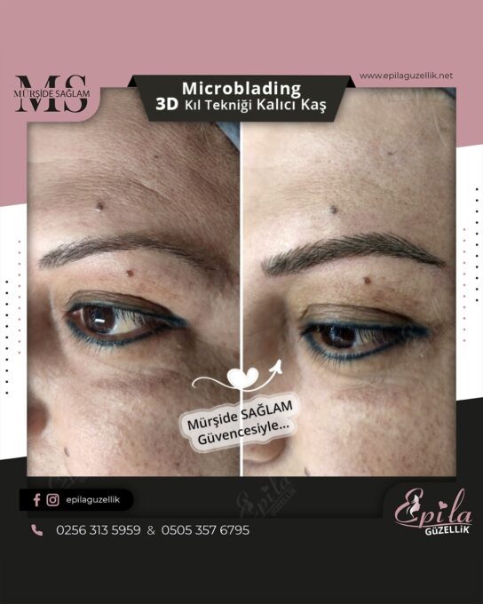 Nazilli - Microblading 3D Kıl Tekniği Kalıcı Kaş Kontürü